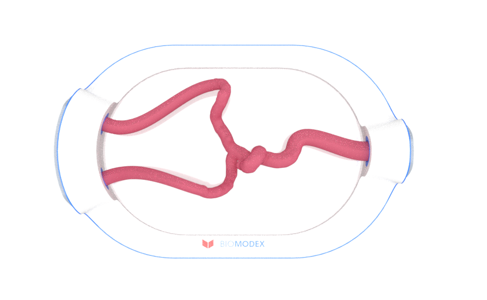 EVIAS -HMS -Cartridge - #0666