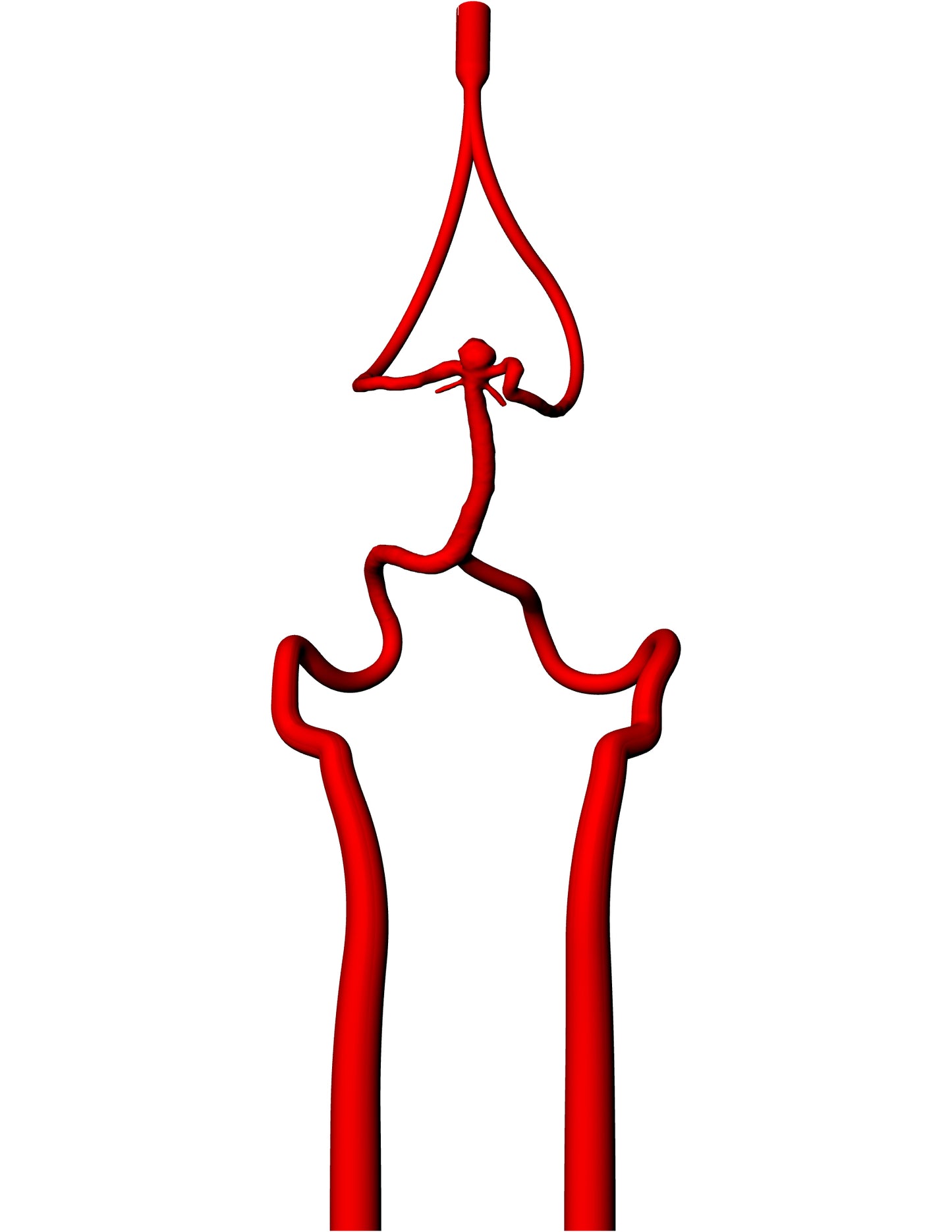 Basilar Terminus Aneurysm Model - AN075