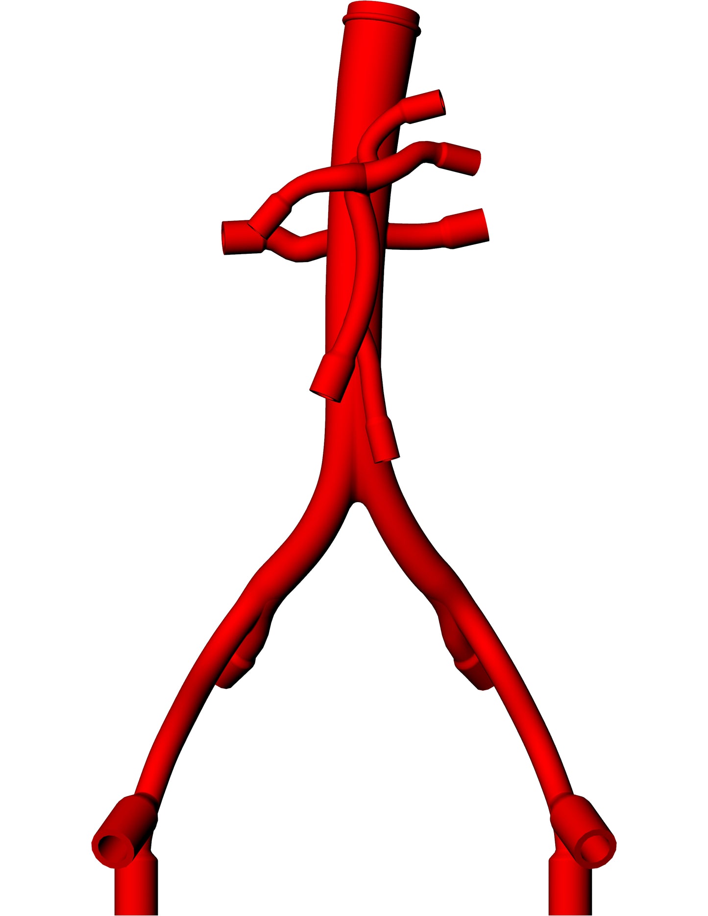 Abdominal Aorta Model - AA016