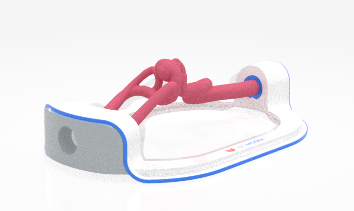 EVIAS -HMS -Cartridge - #0625