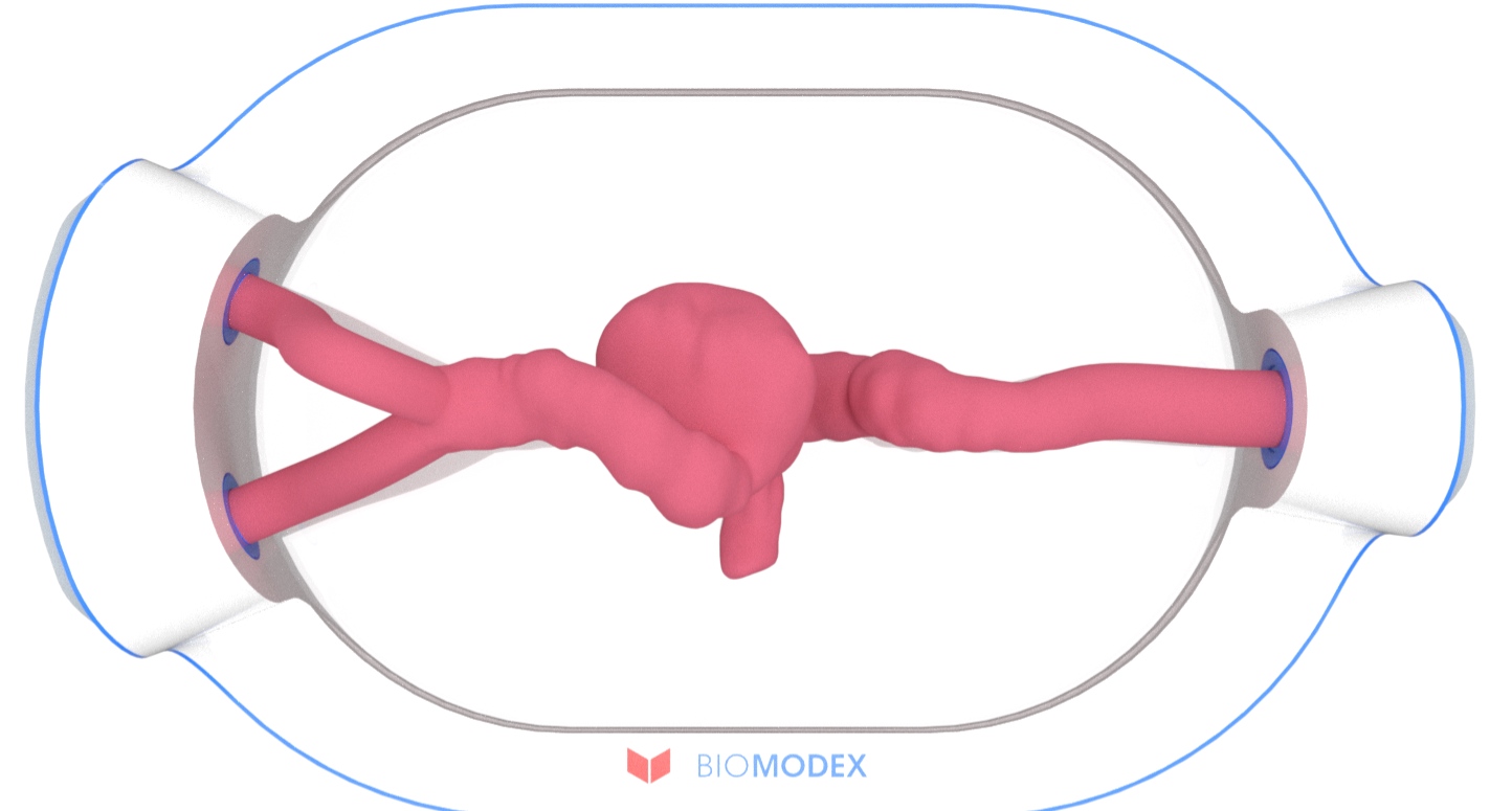 EVIAS -HMS -Cartridge - #0575