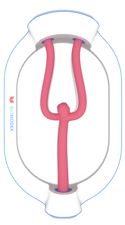 EVIAS -HMS -Cartridge - #0601