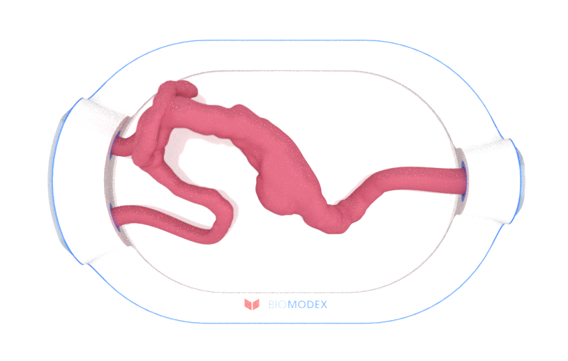 EVIAS -HMS -Cartridge - #0664