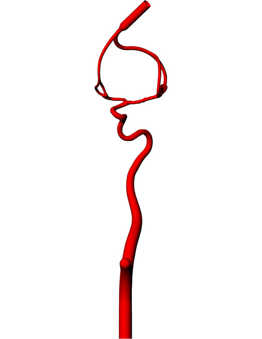MCA Aneurysm Model - AN015