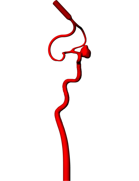 Ophthalmic Aneurysm Model - AN016