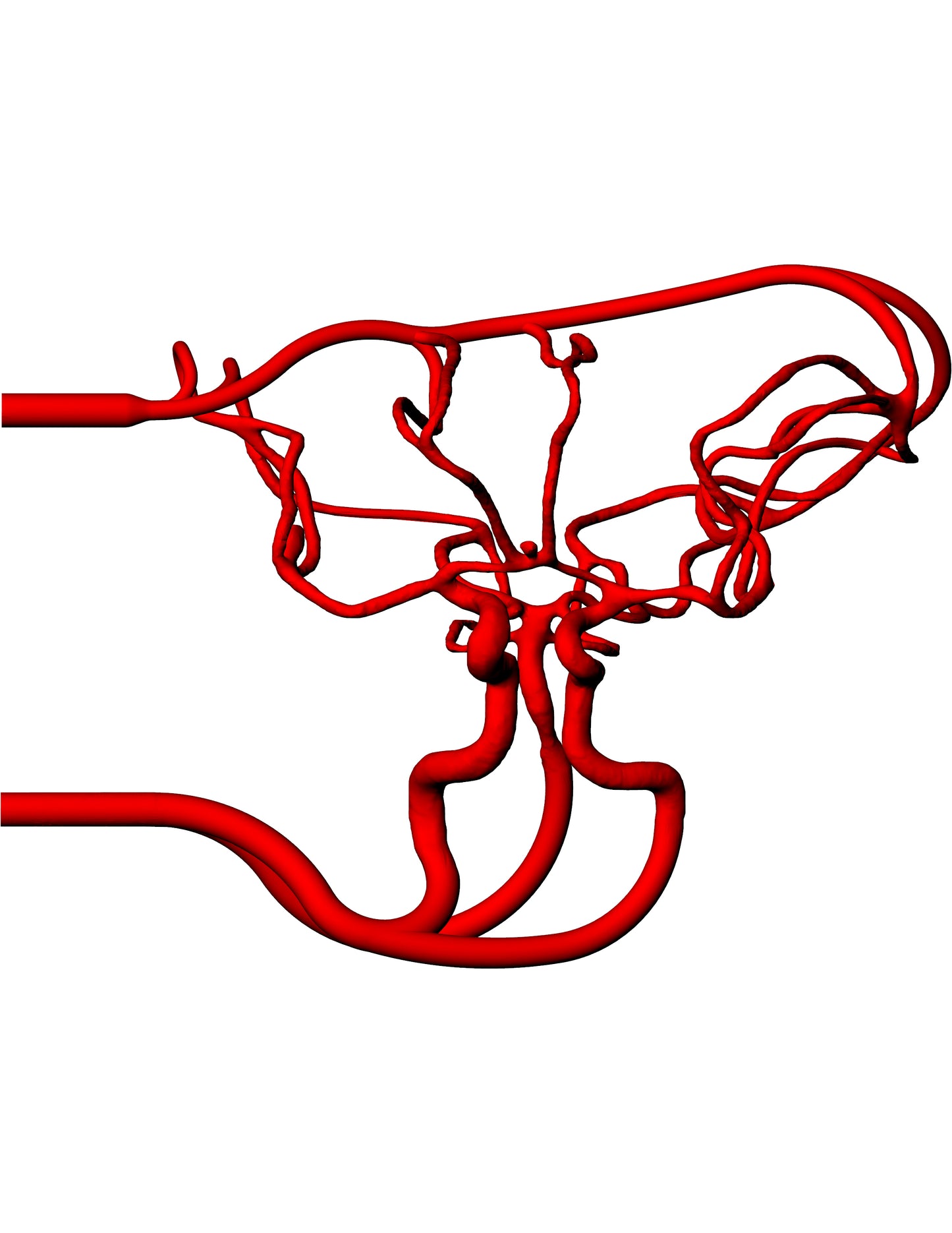 Circle of Willis Model - COW003-1