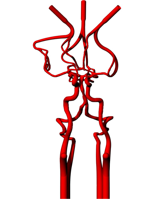 Circle of Willis Model - COW003
