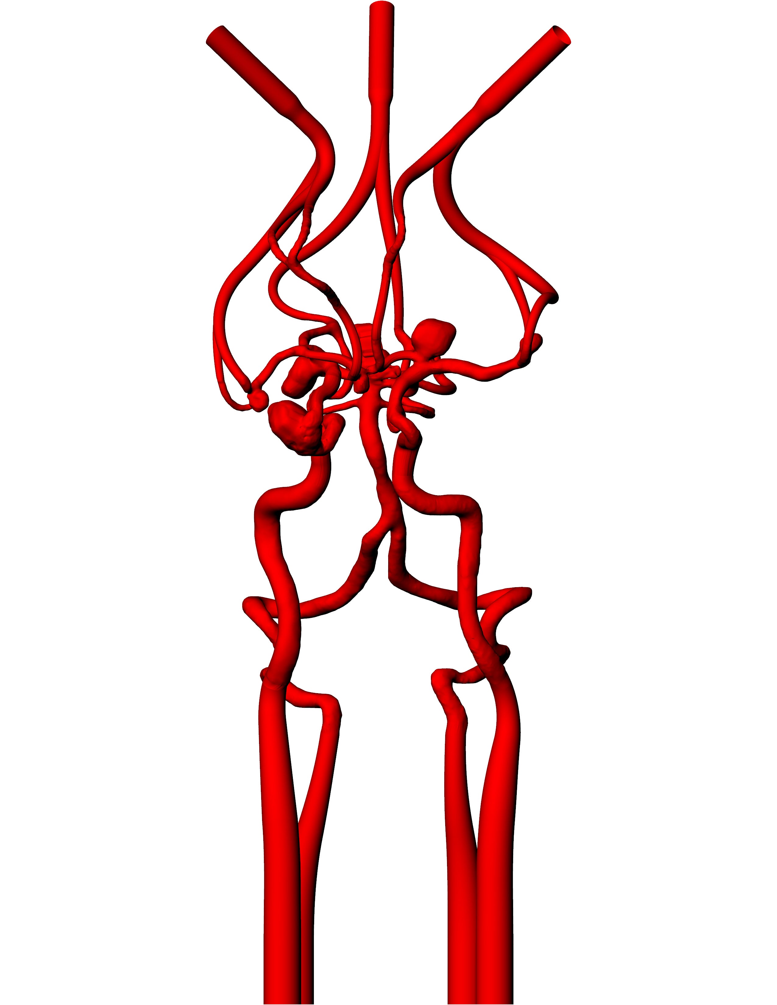 Circle of Willis Model - COW007 – Mentice