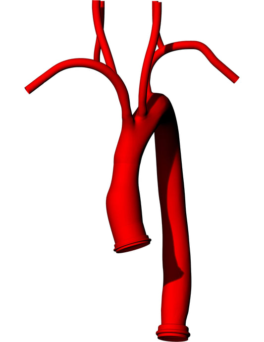Thoracic Aorta Type-III Arch Model - TA004