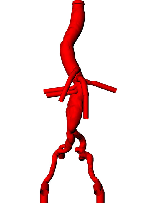 Abdominal Aorta Model - AA012